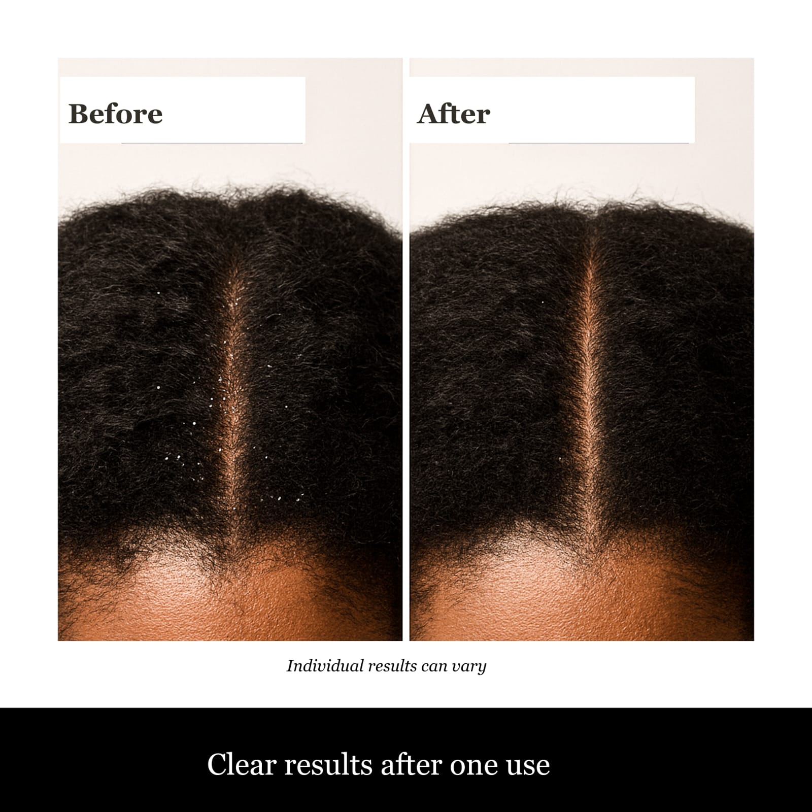 Bo10nics Batana Hair Growth Oil with Tea Tree & Rosemary Mint, 4 oz, Natural Hair Care - Image 8
